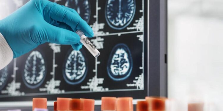 Is There a Cure for Crohns Disease? Expert Insights